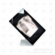 无线探头B超机|探头连接手机成B超诊断仪|远程医疗超声波设备B超